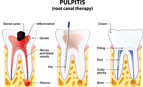 Tiba Dental